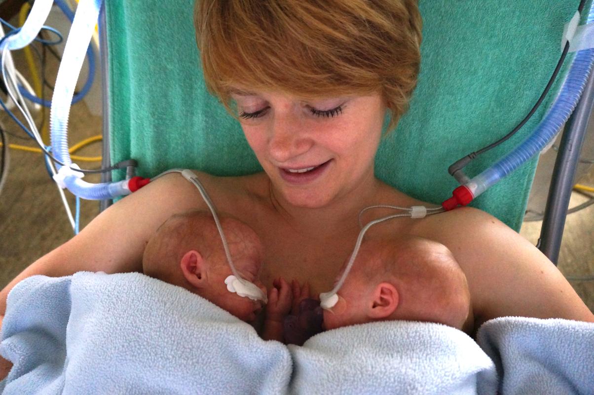 Mama met twee baby's doet aan kangoeroezorg