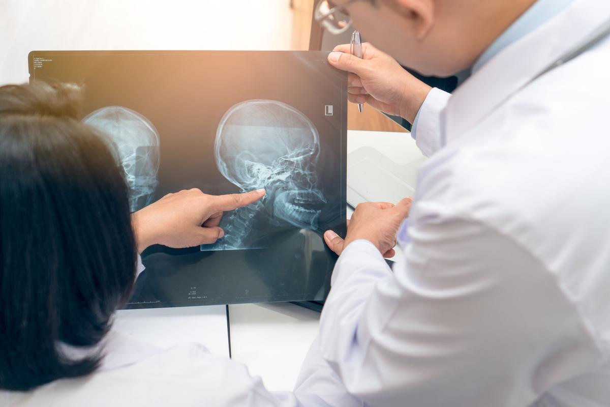 Artsen wijzen naar radiologische beelden