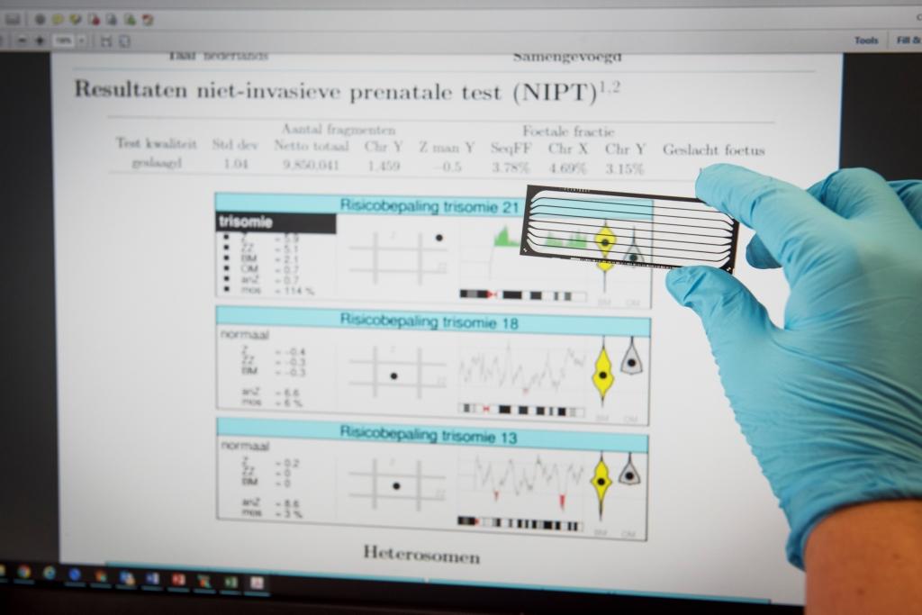 Resultaat van een NIPT