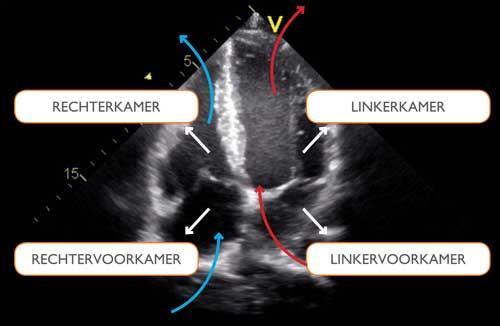 Echocardiogram