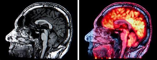 Beeld van PET-MR-scanner