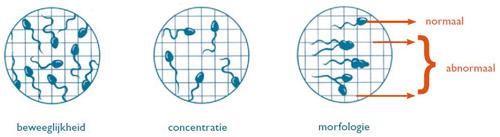 Spermiogram