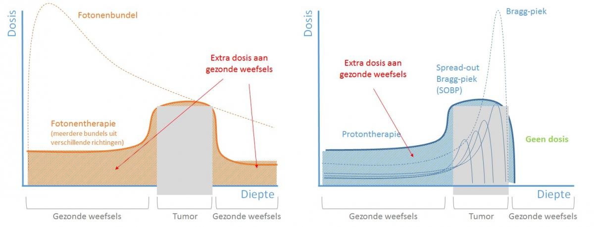 fotontherapie vs protontherapie