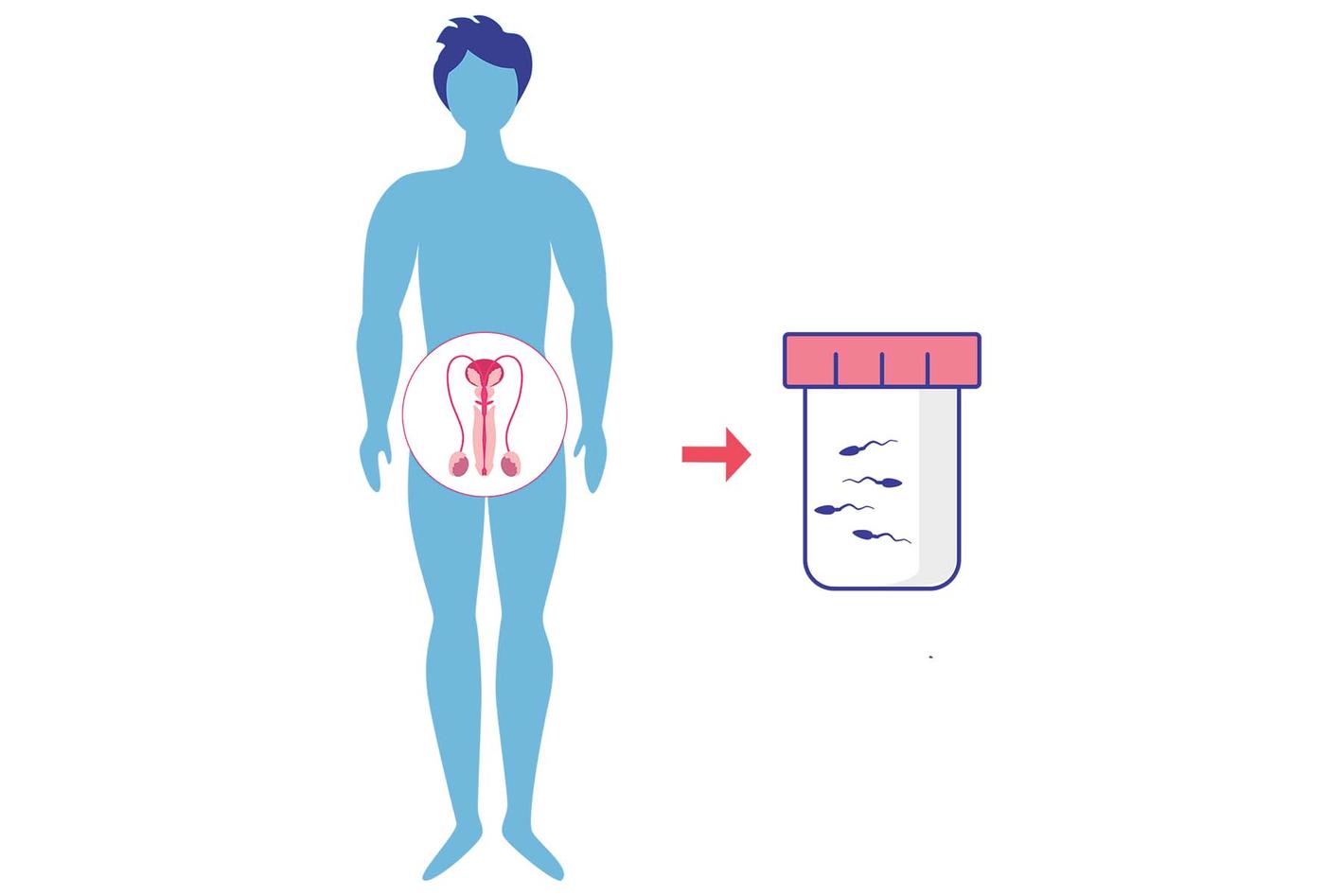 Cryopreservatie door middel van masturbatie | UZ Leuven