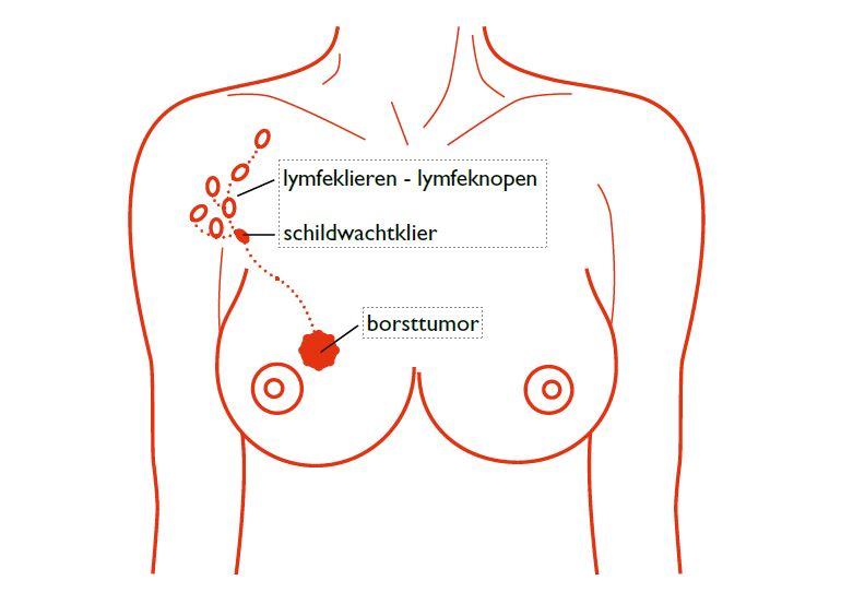 Schildwachtklier