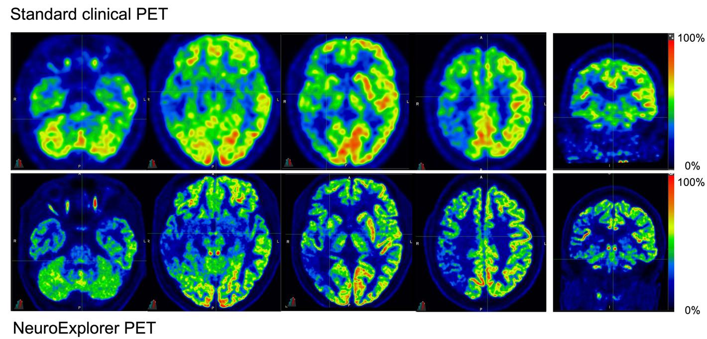 petscan neuroexplorer