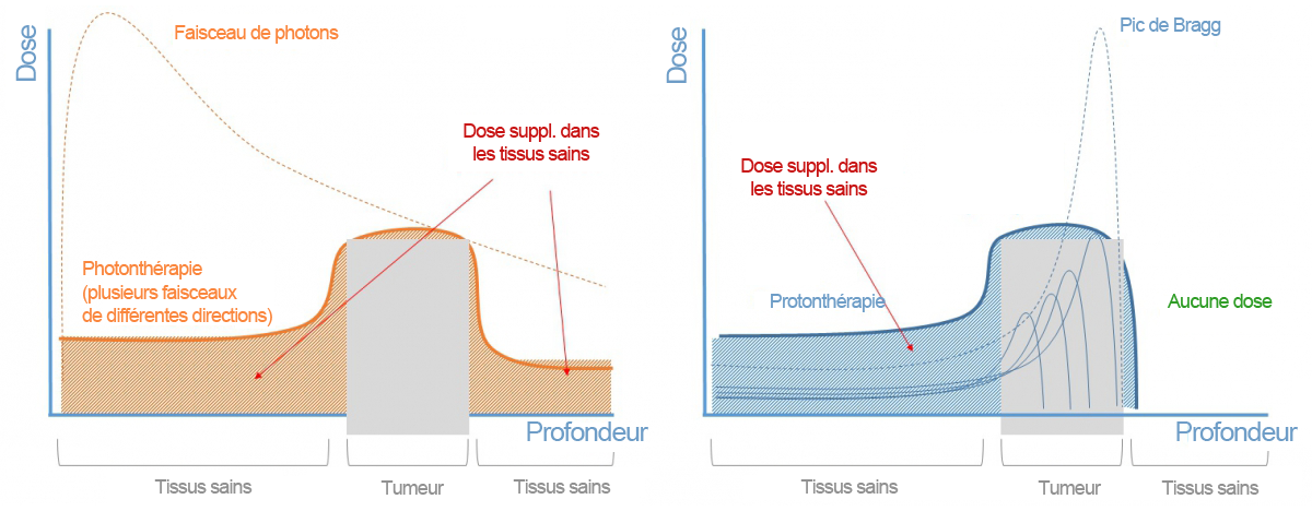 Fotontherapie-vs-protontherapie-FR