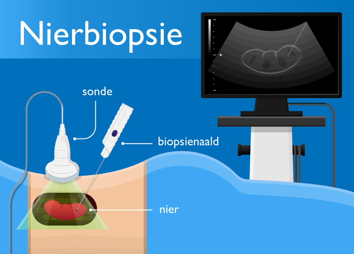 Nierbiopsie procedure