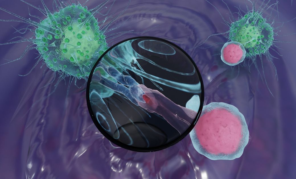 Nieuwe Biomerker Voorspelt Succes Immunotherapie Bij Nierkanker | UZ Leuven